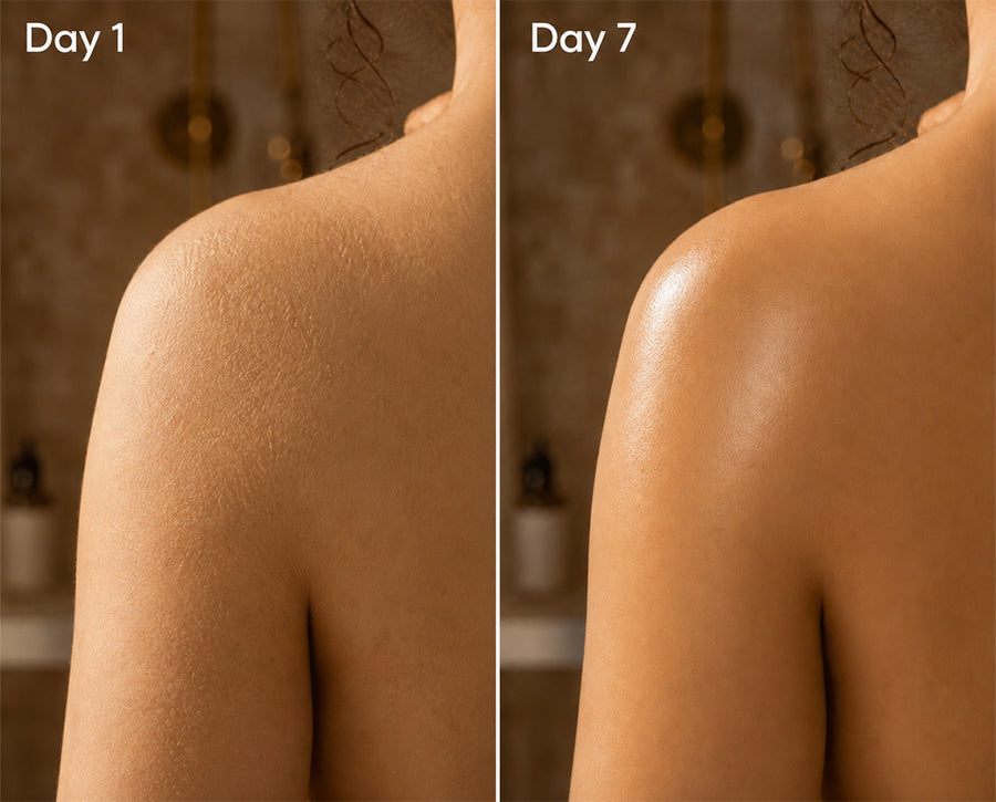 Before and after using Black Soap