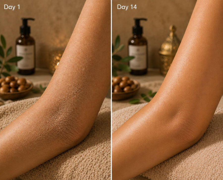 Before and after using Argan Soap