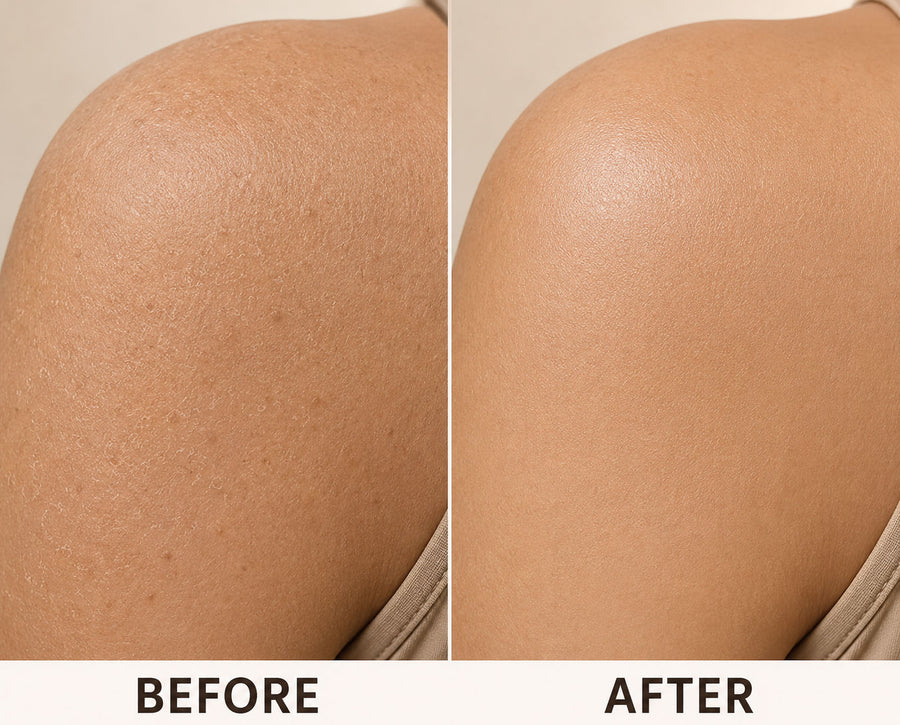 Before and after using Kessa Glove