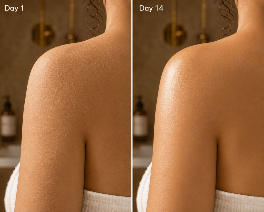 Before and after using Argan Body Lotion